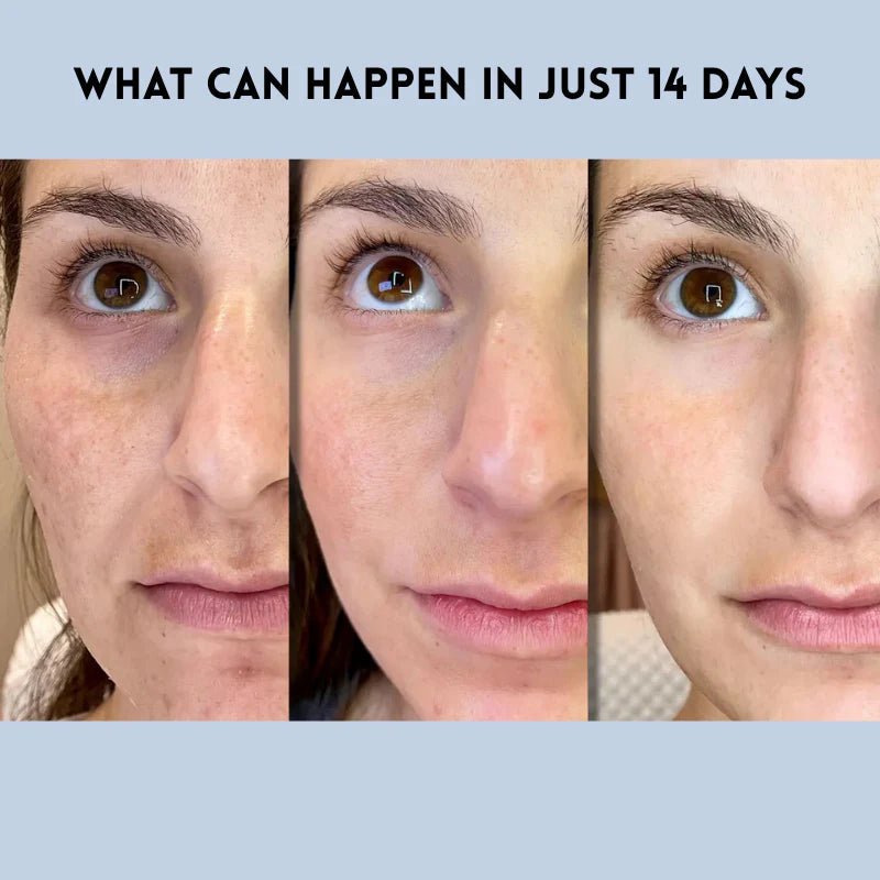 GlowGuard™ — Instantly Lift and Flood Your Skin with Youthful Power (Facial Care ) - | Zavonix
