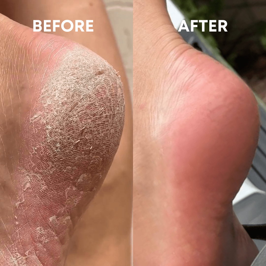 CheekyStride™ Crystal Foot File — Effortless Luxury That Turns Rough Feet Into Silky Sensations