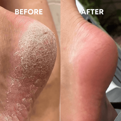 CheekyStride™ Crystal Foot File — Effortless Luxury That Turns Rough Feet Into Silky Sensations