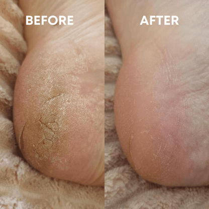 CheekyStride™ Crystal Foot File — Effortless Luxury That Turns Rough Feet Into Silky Sensations