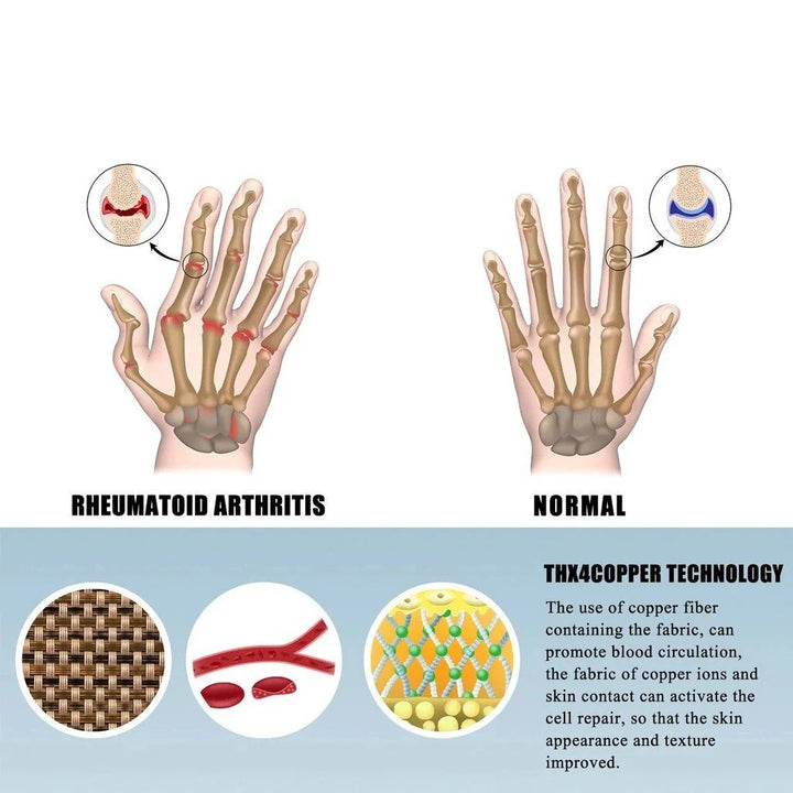 Arthra Compression Gloves | Gentle Support for Arthritis and Hand Pain Relief 3