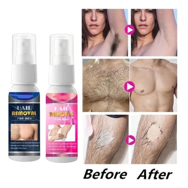 Breezy Hair Removal Spray for Men | Pain-Free, Nourishing Formula 0