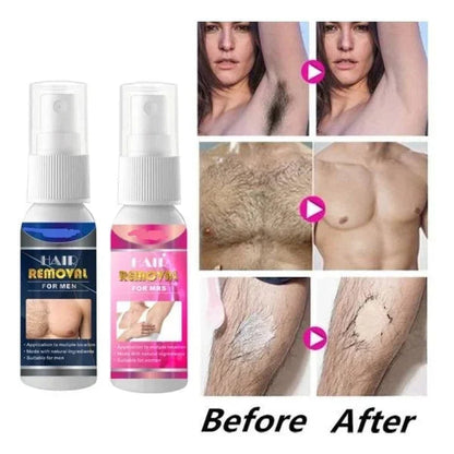 Breezy Hair Removal Spray for Men | Pain-Free, Nourishing Formula 0