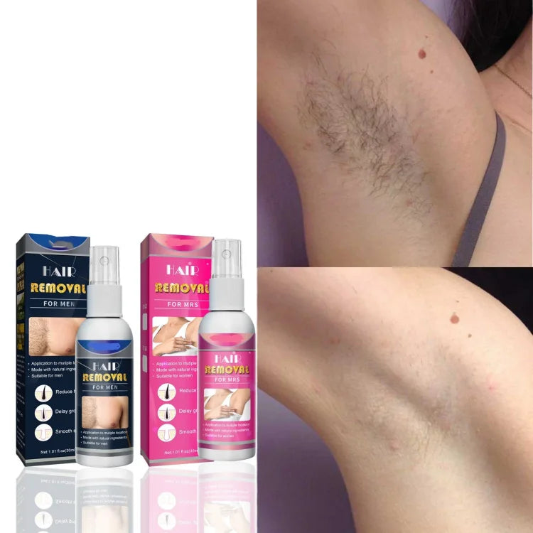 Breezy Hair Removal Spray for Men | Pain-Free, Nourishing Formula 4