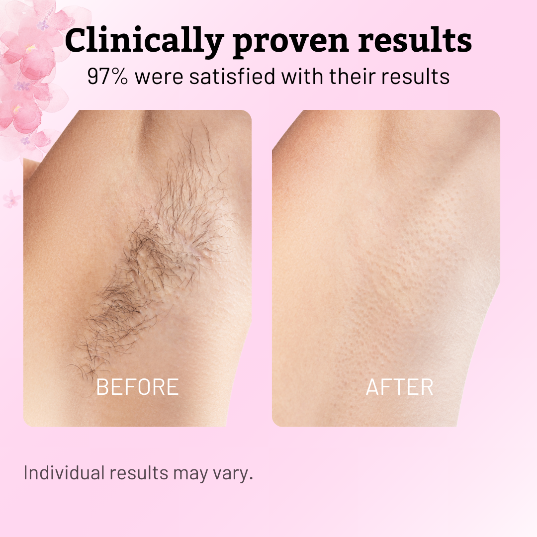 Cypress Hair Reduction Oil | Natural Blend for Smooth Skin 3