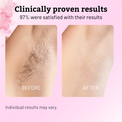 Cypress Hair Reduction Oil | Natural Blend for Smooth Skin 3