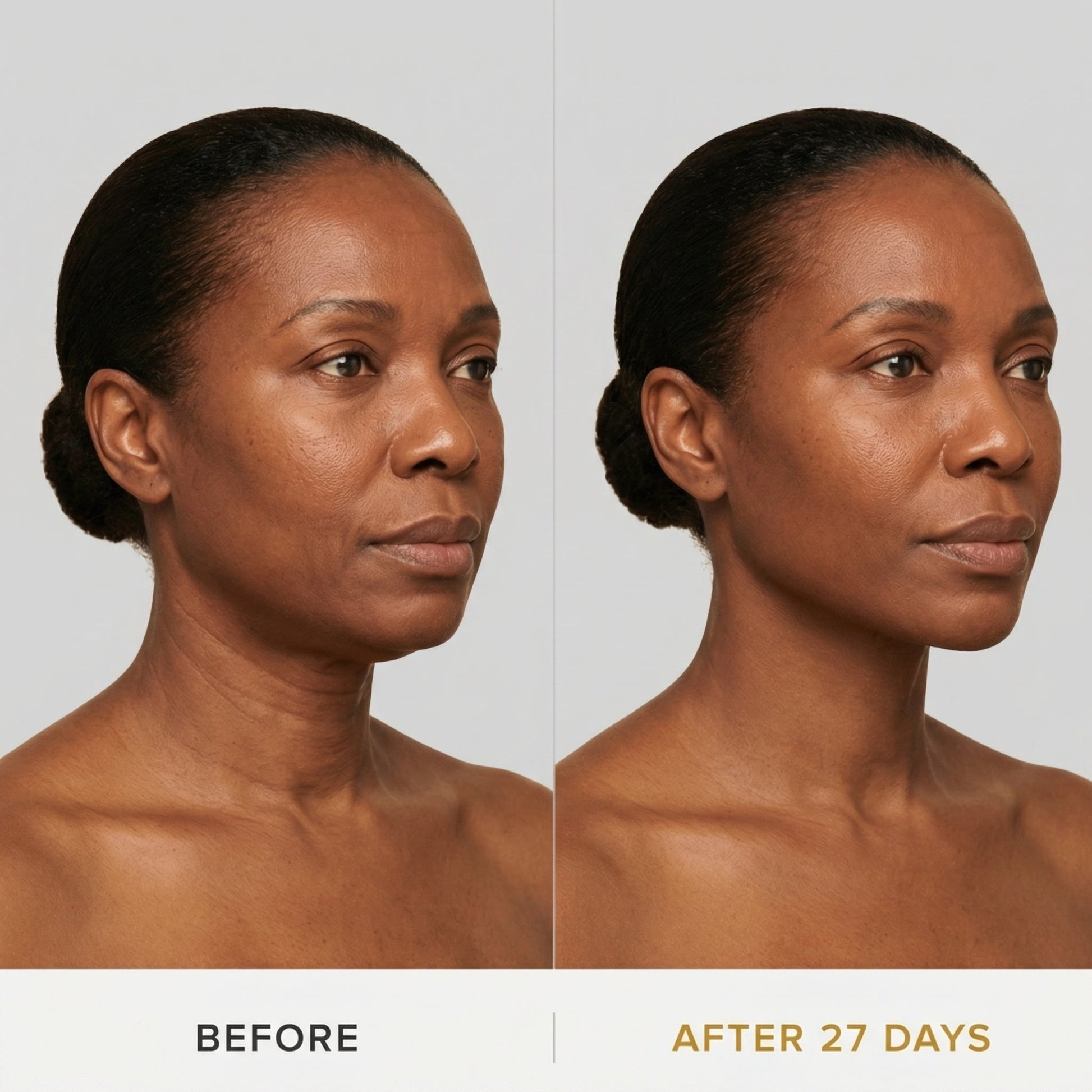 JAWLIFT Mask | Sculpting Jawline Enhancer, Second-Skin Fit 2