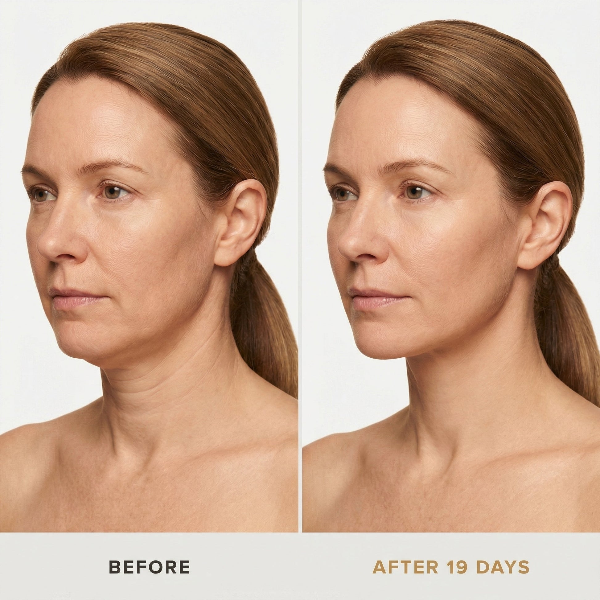 JAWLIFT Mask | Sculpting Jawline Enhancer, Skin-Friendly Fabric 4