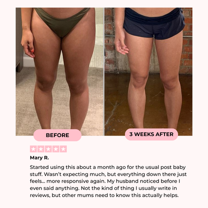 Mireva Fit Thigh Trainer | Durable, Compact Design for Strengthening and Toning 2