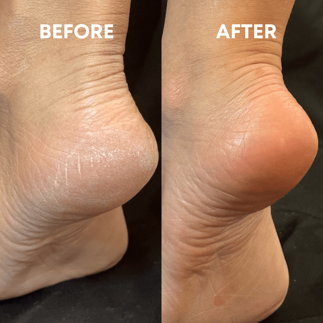 CheekyStride™ Crystal Foot File — Effortless Luxury That Turns Rough Feet Into Silky Sensations