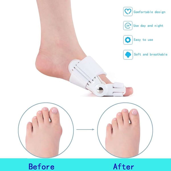 Balanceease Bunion Corrector Toe Alignment Support Product Image 07