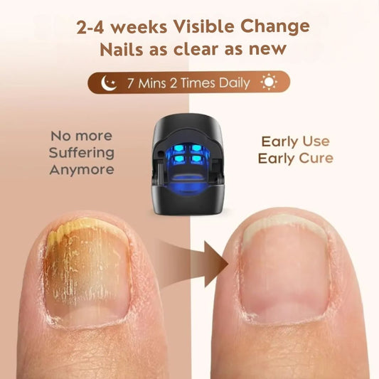 RevitaNail™ — Transform Your Nails into Bold, Flawless Powerhouses in Weeks
