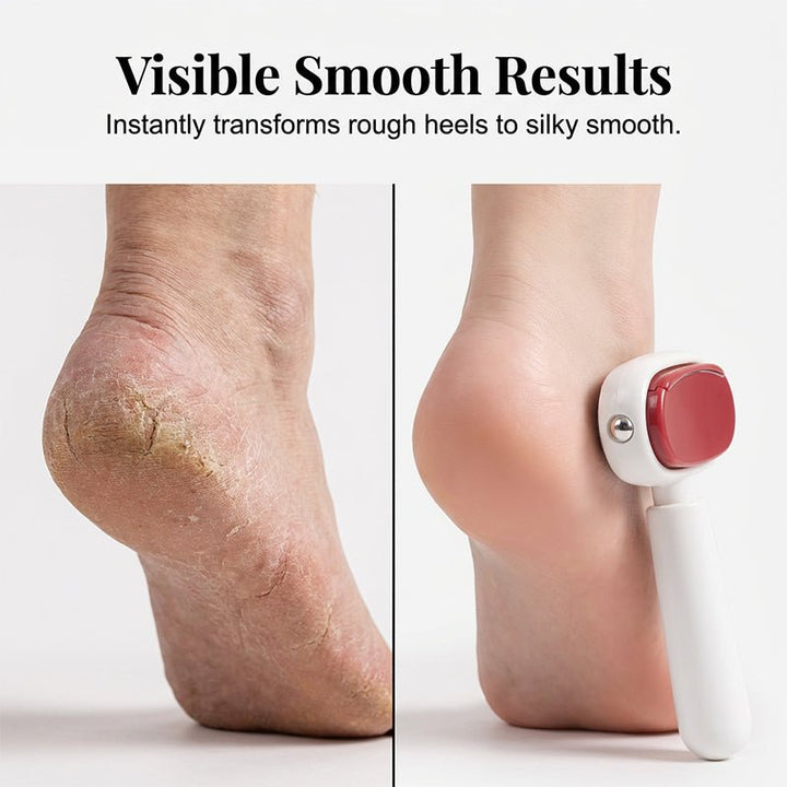 Dailysmooth Stainless Callus File Product Image 03