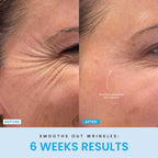 FaceVolt™ — Reclaim Your Youthful Glow and Sculpted Jawline in Minutes (White ) - Facial Sculptor | Zavonix