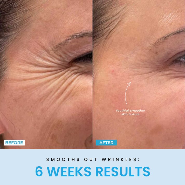 FaceVolt™ — Reclaim Your Youthful Glow and Sculpted Jawline in Minutes (White ) - Facial Sculptor | Zavonix