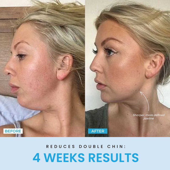 FaceVolt™ — Reclaim Your Youthful Glow and Sculpted Jawline in Minutes (White ) - Facial Sculptor | Zavonix