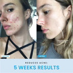FaceVolt™ — Reclaim Your Youthful Glow and Sculpted Jawline in Minutes (White ) - Facial Sculptor | Zavonix