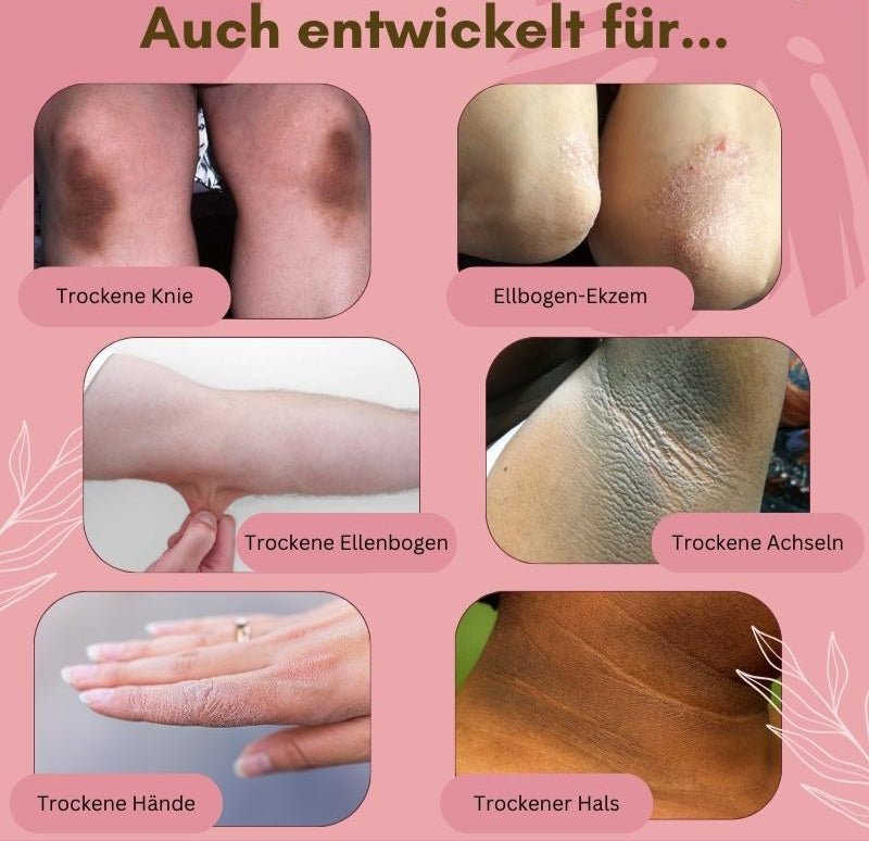 FootArmor™ — Crush Cracks and Unleash Silky, Unstoppable Skin ( ) - Callus remover | Zavonix