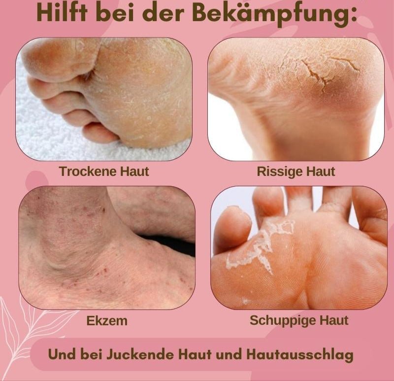 FootArmor™ — Crush Cracks and Unleash Silky, Unstoppable Skin ( ) - Callus remover | Zavonix