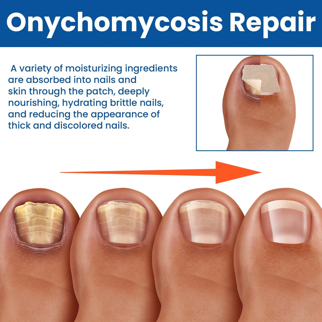 Fungal Nail Restoration Patches 60pcs