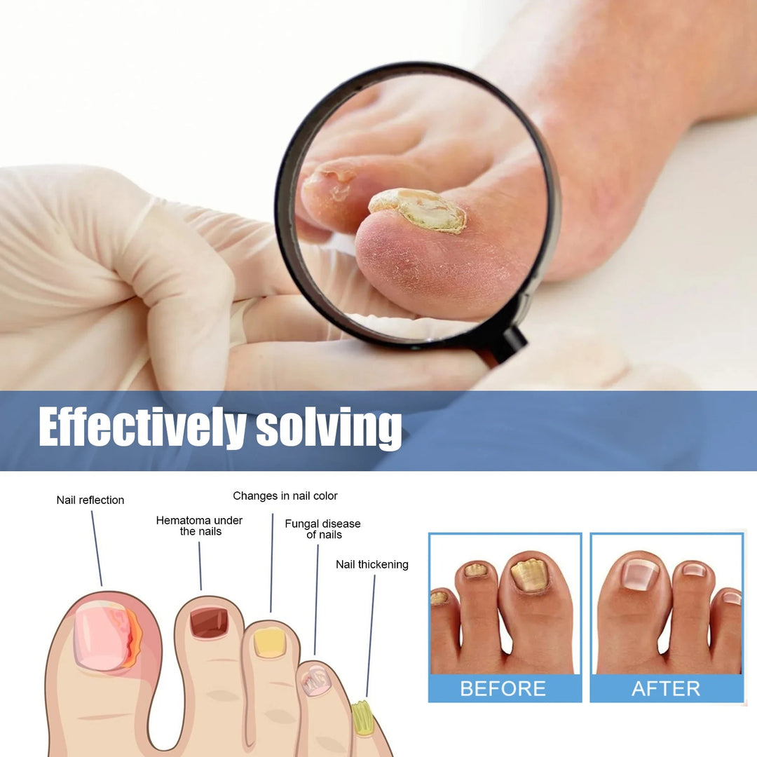 Fungal Nail Restoration Patches 60pcs
