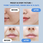 GlowGuard™ — Instantly Lift and Flood Your Skin with Youthful Power (Facial Care ) - | Zavonix