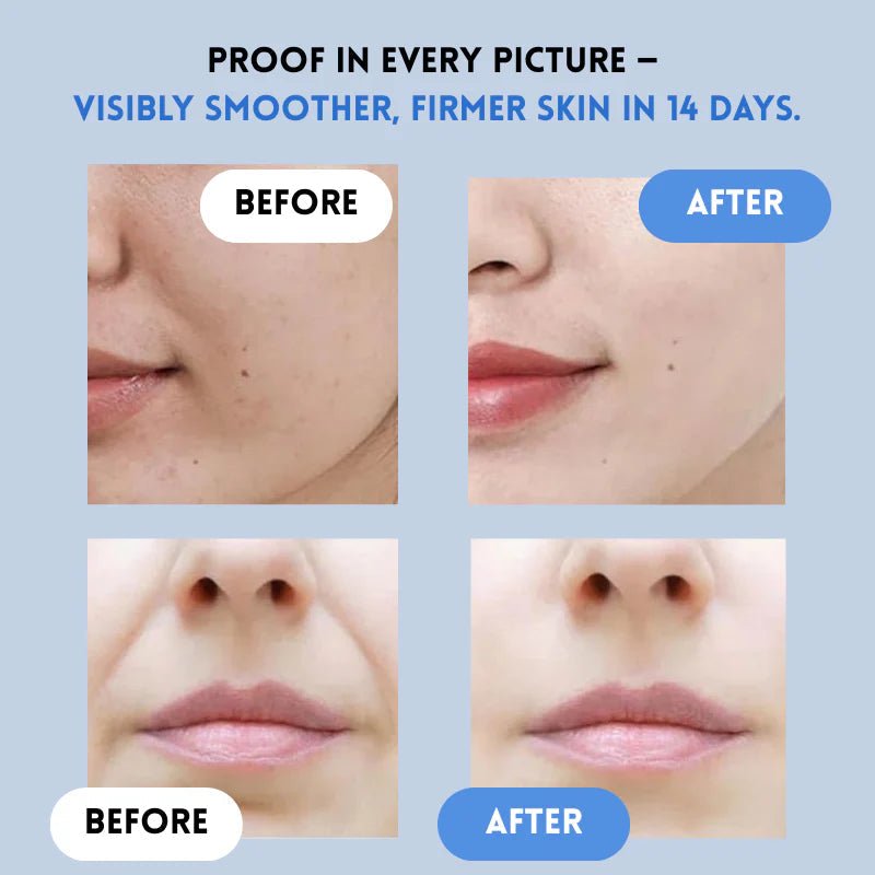 GlowGuard™ — Instantly Lift and Flood Your Skin with Youthful Power (Facial Care ) - | Zavonix