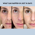 GlowGuard™ — Instantly Lift and Flood Your Skin with Youthful Power (Facial Care ) - | Zavonix