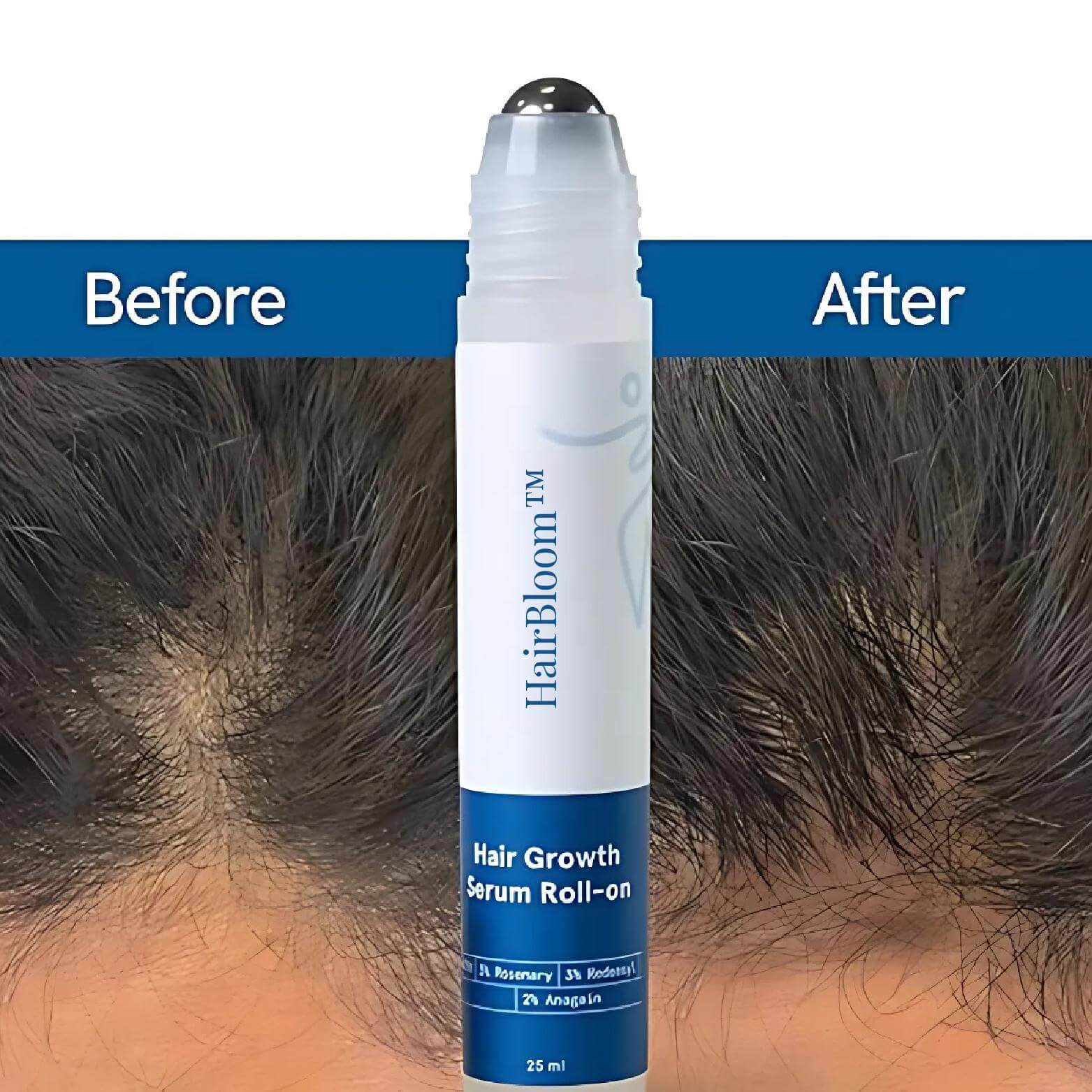 HairIgnite™ — Unleash Lush, Thick Hair That Commands Confidence (50% Discount ) - | Zavonix