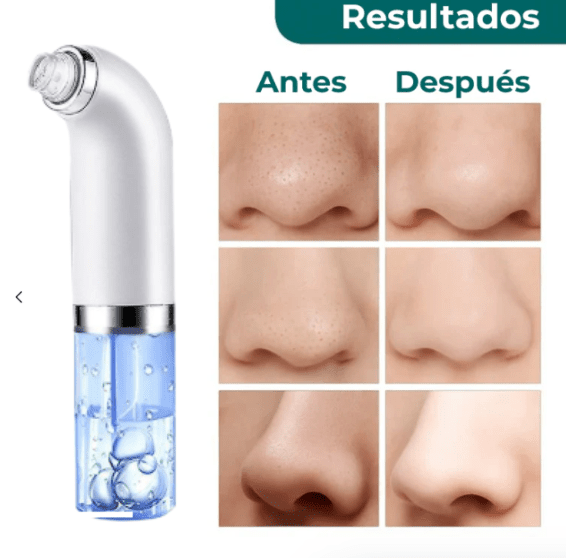 LumiPure™ — Descubre una piel irresistiblemente suave y clara que atrae todas las miradas
