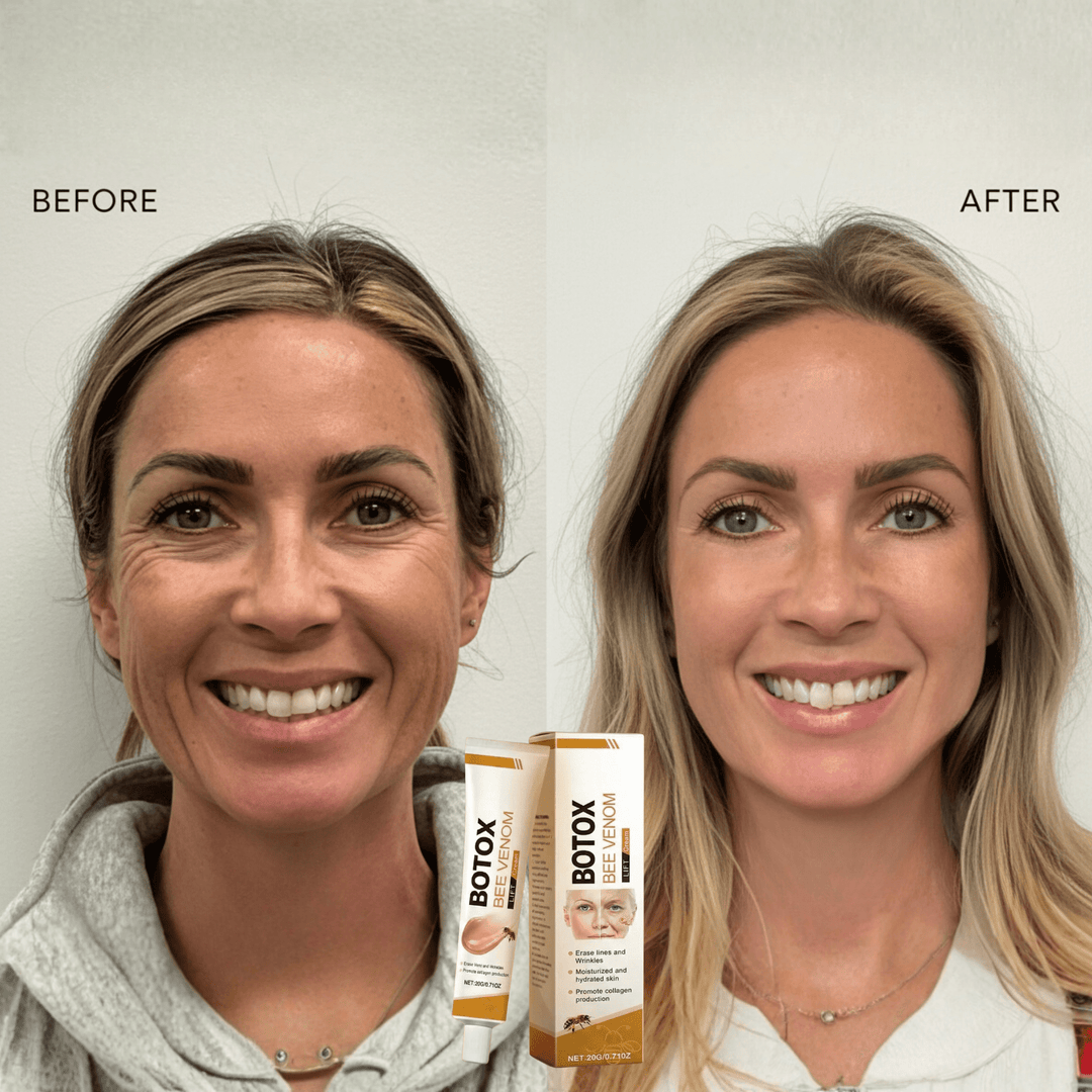 Melissara™ Bee Venom Rejuvenation Cream