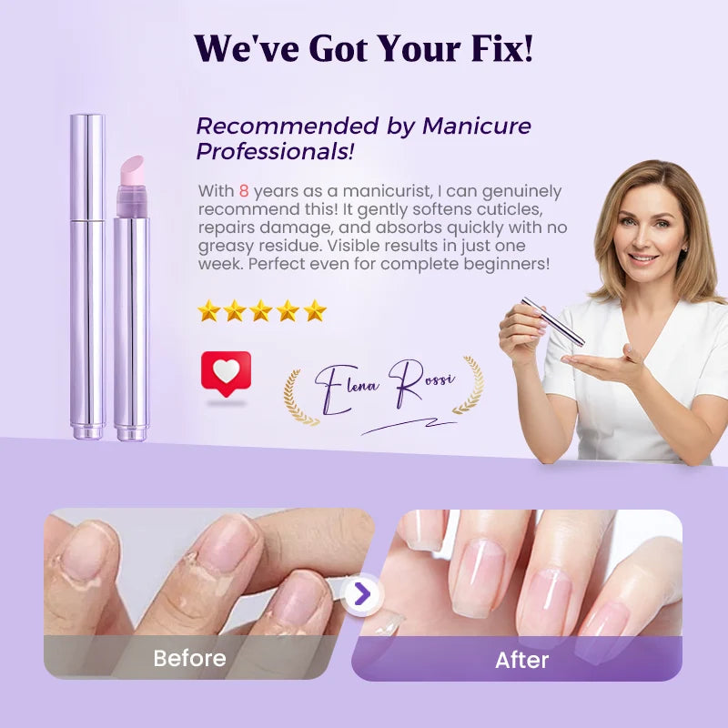 Nail Care Pen Cuticle Polish Remover Oil Treatment Product Image 04