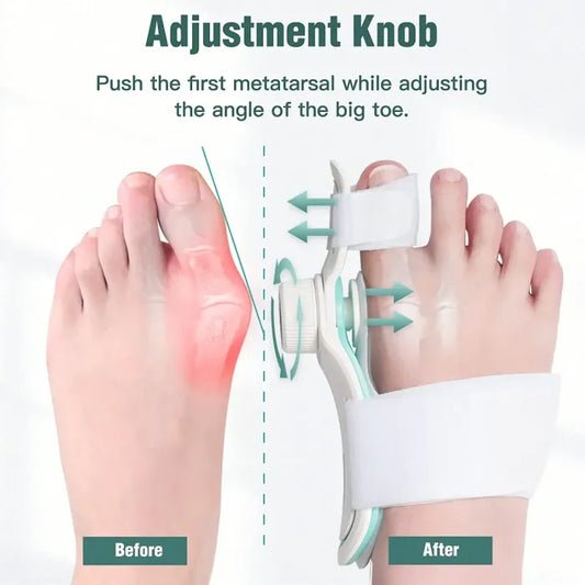 Bunion Corrector Unisex Foot Hallux Valgus Braces Rotatable Toe Separator Straightener Adjustable Pedicure Finger Toe Corrector