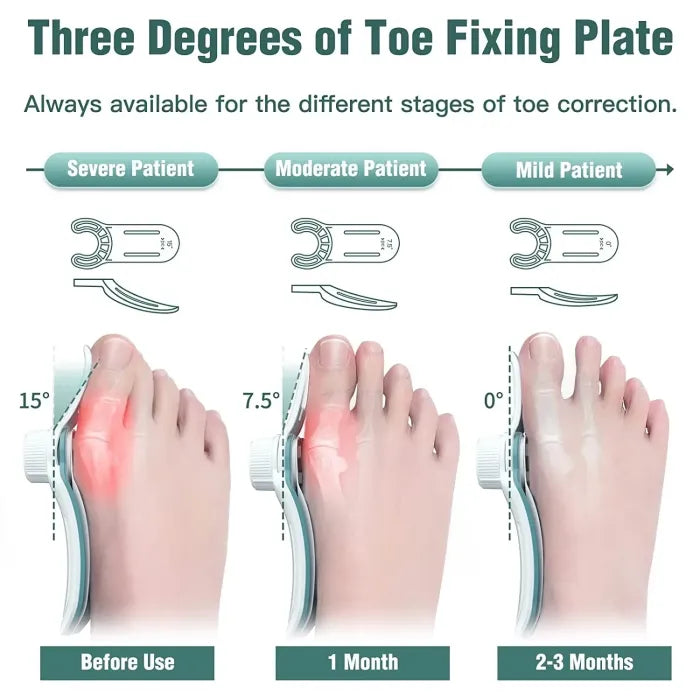 Bunion Corrector Unisex Foot Hallux Valgus Braces Rotatable Toe Separator Straightener Adjustable Pedicure Finger Toe Corrector