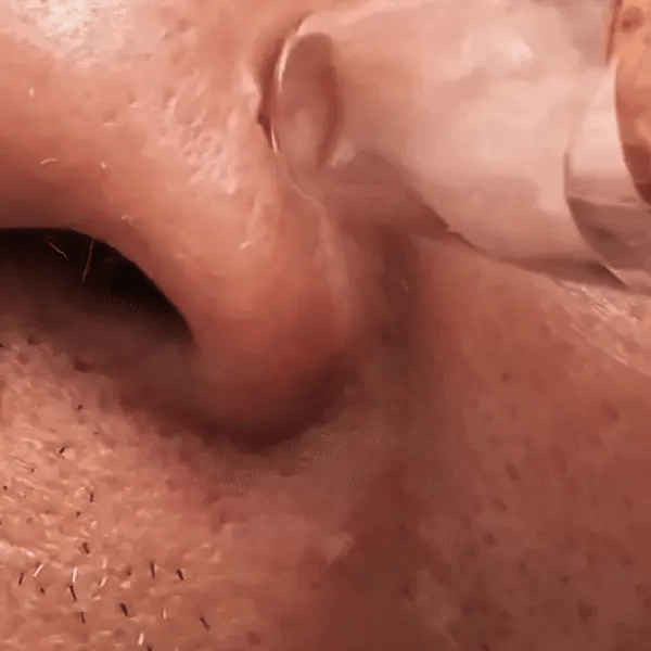 PoreVac™ — Unleash Radiant Skin That Turns Heads Instantly