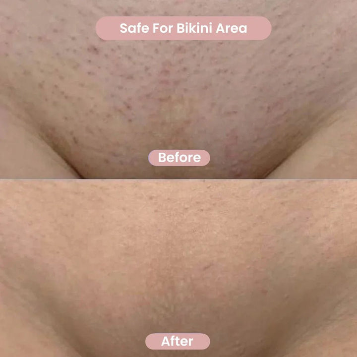 SilkSlick™ — Glide to Silky Smooth Confidence Instantly