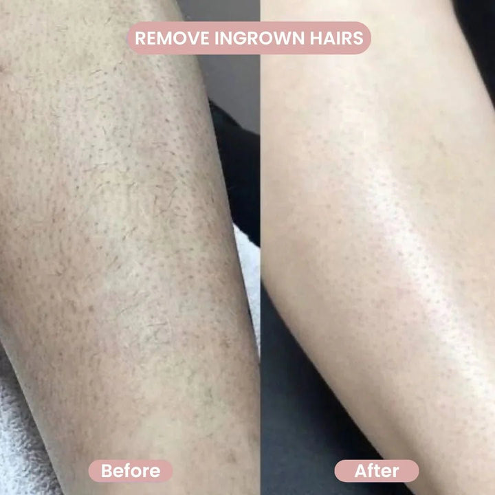 SilkSlick™ — Glide to Silky Smooth Confidence Instantly