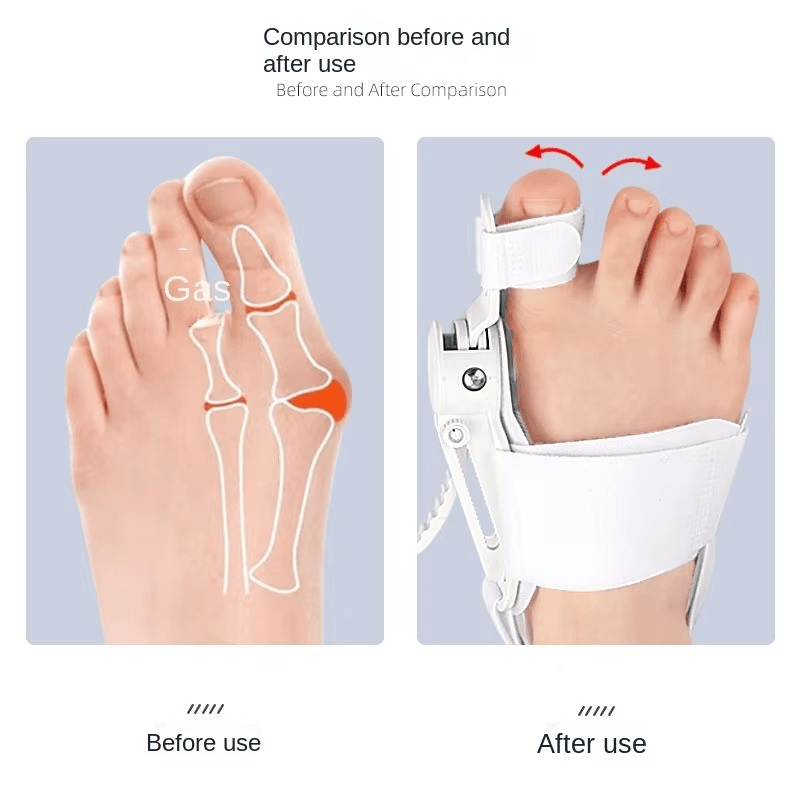 ToeAligner™ — Step Pain - Free and Shine with Perfectly Straight Toes (1 pc only ) - Foot & Toe Orthotics | Zavonix