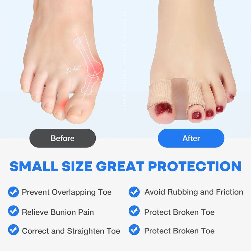 ToeSnap™ — Walk Pain-Free All Day with Invisible, Soothing Relief